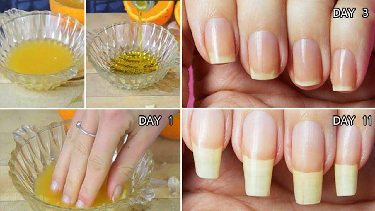 Как отрастить ногти за неделю? как отрастить крепкие ногти :: syl.ru