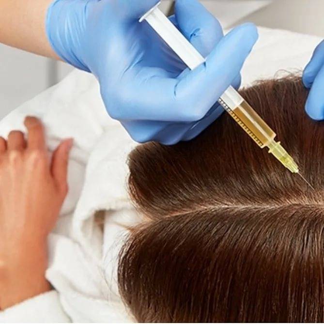 Мезотерапия для роста и восстановления волос. стоит ли делать мезотерапию кожи головы