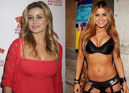 Самые безумные операции знаменитостей по увеличению груди: до и после