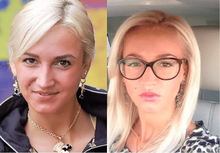 Ольга бузова до и после пластических операций и косметологических процедур +фото
