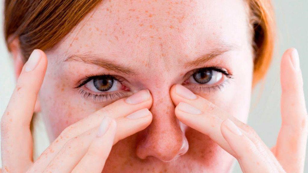 Покраснение глаз: основные причины и заболевания, вызывающие покраснение склеры. когда при покраснении глаз необходимо обращаться к врачу