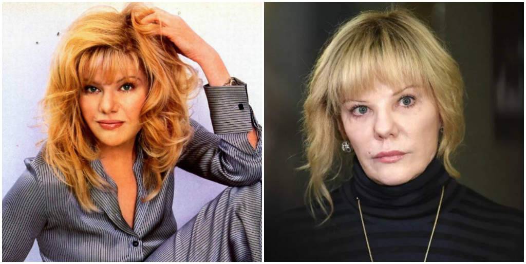 Александра Захарова до и после пластики. Фото