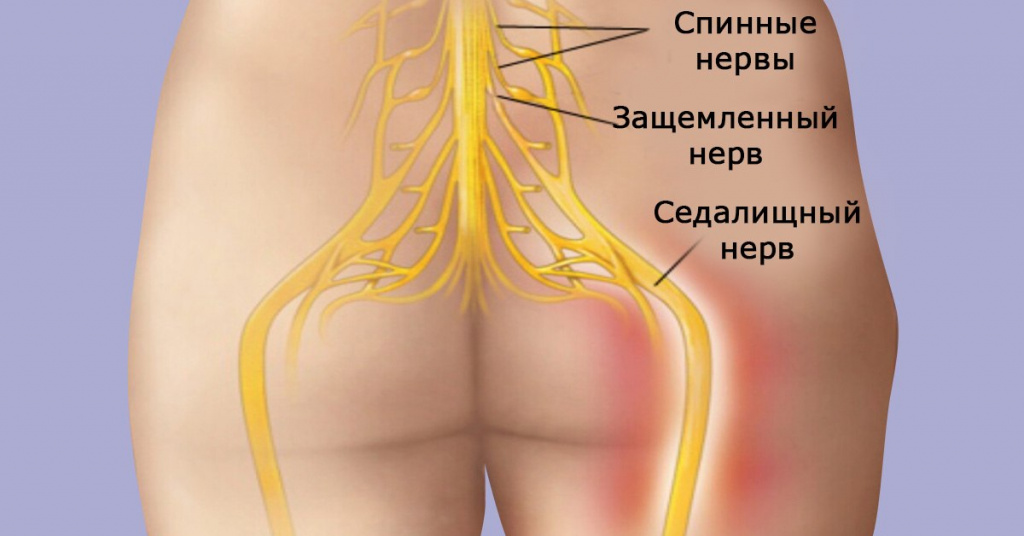 Сакральная мышца