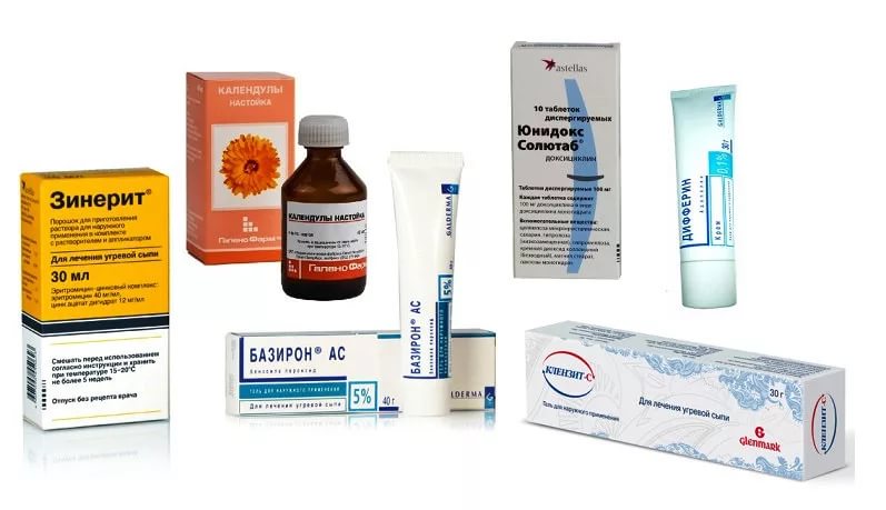 Прыщи на лице. причины высыпаний, классификация и методы лечения