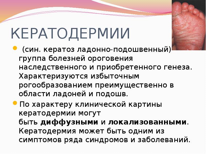 Гиперкератоз кожи лица * клиника диана в санкт-петербурге