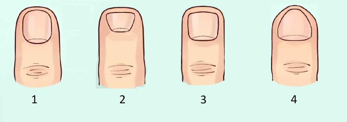 Что говорит форма ногтей о человеке. как узнать характер человека по форме ногтей