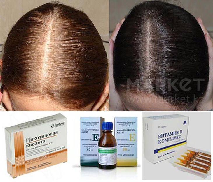 Витамин b6 для укрепления и роста волос