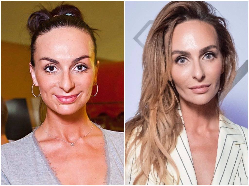 Екатерина варнава до и после пластики носа, груди и лица. какие операции делала актриса и как она похудела – фото 2019 года