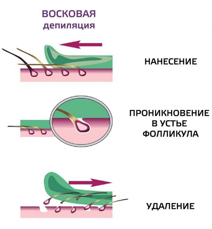 Как делать эпиляцию горячим воском в домашних условиях?