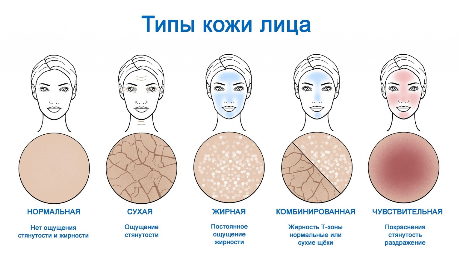 Типы кожи сухая жирная нормальная комбинированная