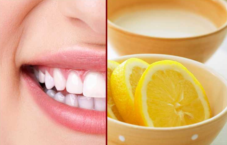 Как отбелить зубы — вред и польза домашнего отбеливания