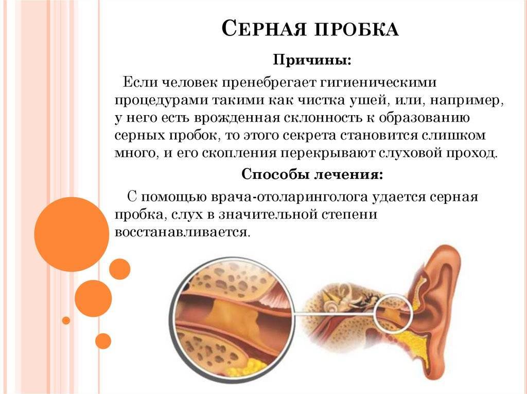 Удаление серной пробки из ушей: капли от заложенности, очистка в клинике