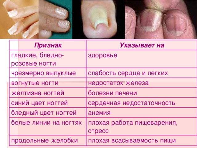 Ногти: основные заболевания