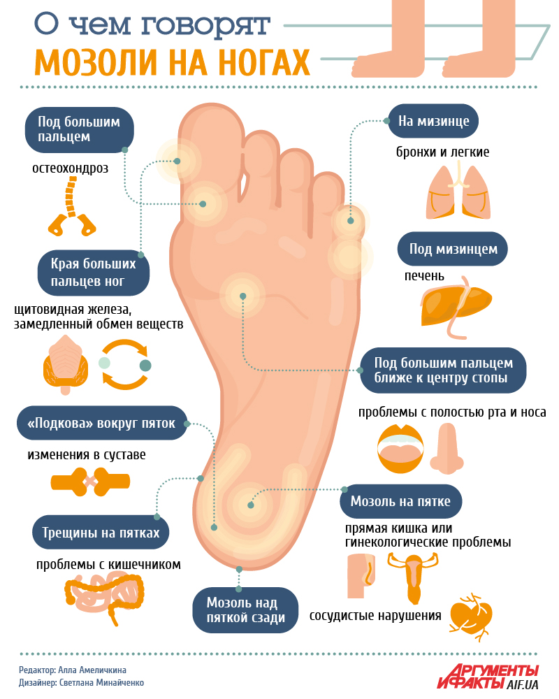Болезни стопы человека в картинках и название и лечение