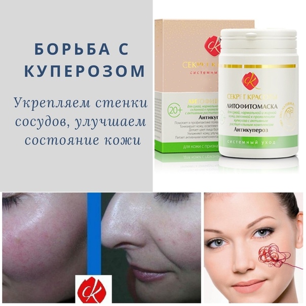 ᐈ что такое купероз? ~【лечение в киеве】