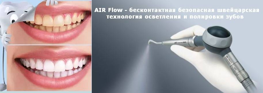 Ультразвуковая чистка зубов air flow