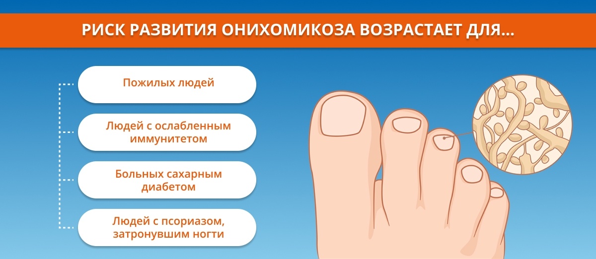 Что делать, чтобы ноготь не почернел: советы медиков | красивые ногти - дополнение твоего образа
