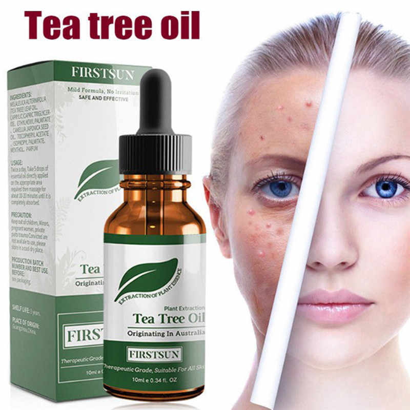 Эфир чайного дерева – средство №1 для ухода за проблемной кожей