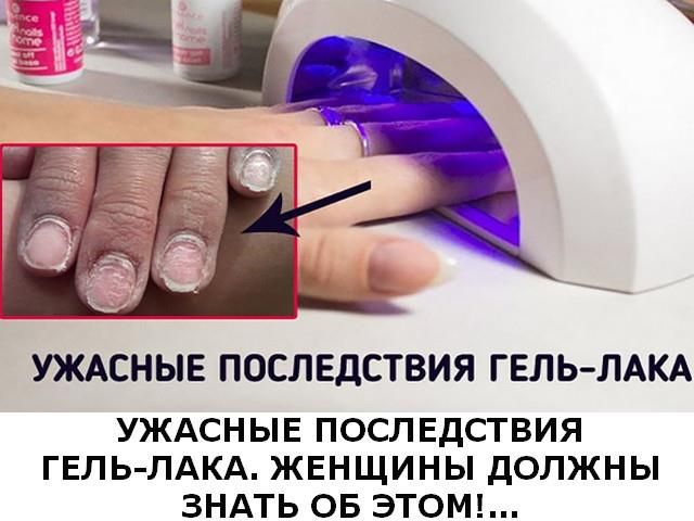 Вреден ли гель-лак для ногтей: какой реальный вред, как влияет, за и против покрытия, портит ли, как часто делать, противопоказания