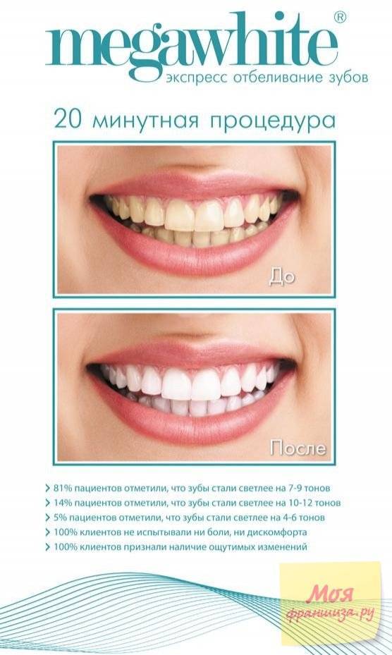 Фотоотбеливание зубов – виды, фото до и после, отзывы