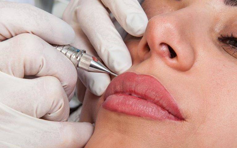 Подтяжка уголков рта – как убрать хмурое выражение и «линии марионеток» - клиника косметологии