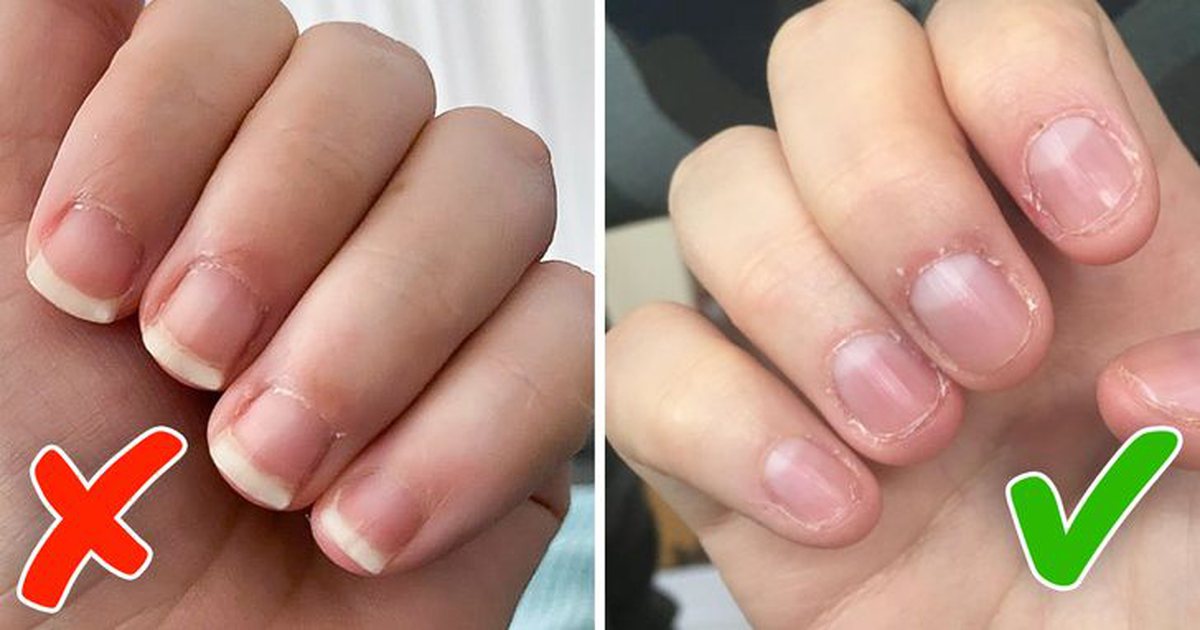 Как отучиться грызть ногти?