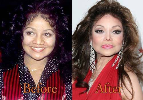 Майкл джексон до и после пластических операций, фото и видео » womanmirror