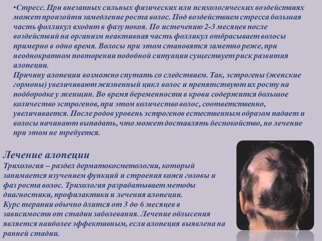 Причину выпадения волос после 40. Влияние стресса на волосы. Облысение у мужчин и женщин.