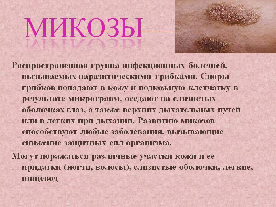 Пиодермия * клиника диана в санкт-петербурге