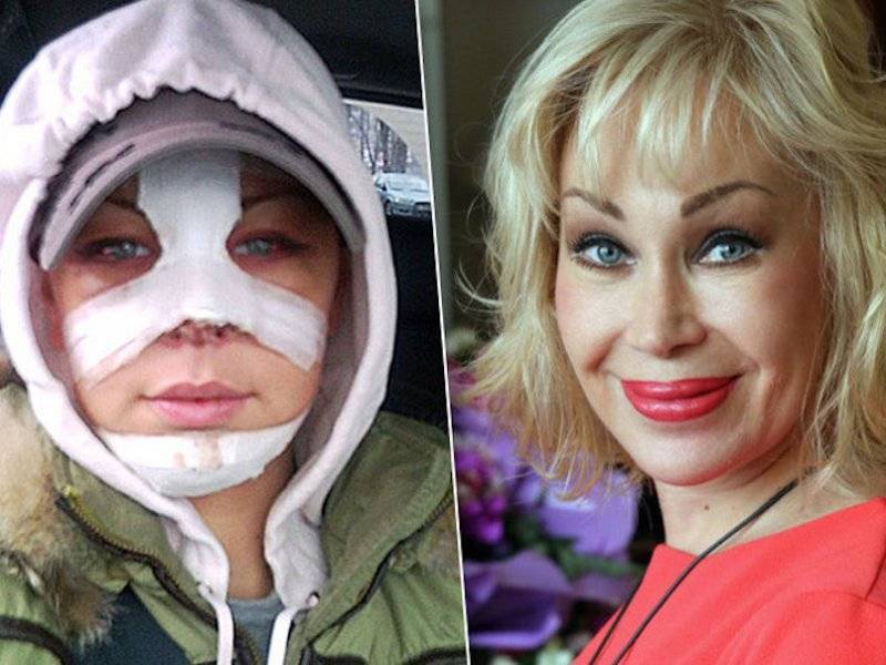 Звезды певица саша project отсудила у пластических хирургов, изуродовавших ее лицо, два миллиона рублей