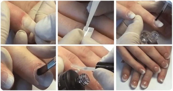 Наращивание ногтей гелем на типсы — как сделать, какие этапы -