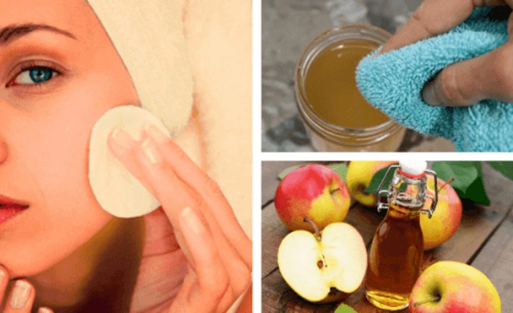Яблочный уксус: лечение кожи в домашних условиях