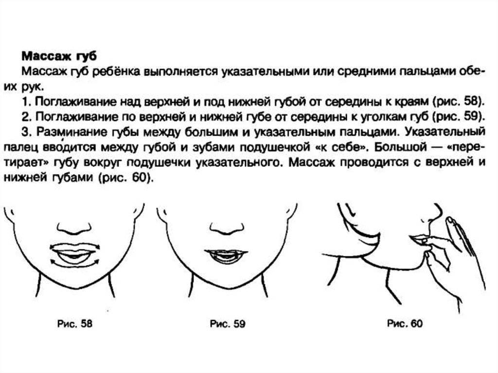 Сколько делать массаж губ. Логопедический массаж при ринолалии. Логопедический массаж губ. Логопедический массаж верхней губы. Логопедический массаж лица в схемах.