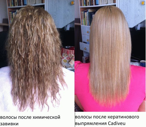 Как сохранить волосы при химиотерапии от выпадения? всегда ли после химиотерапии выпадают волосы? | клиники «евроонко»