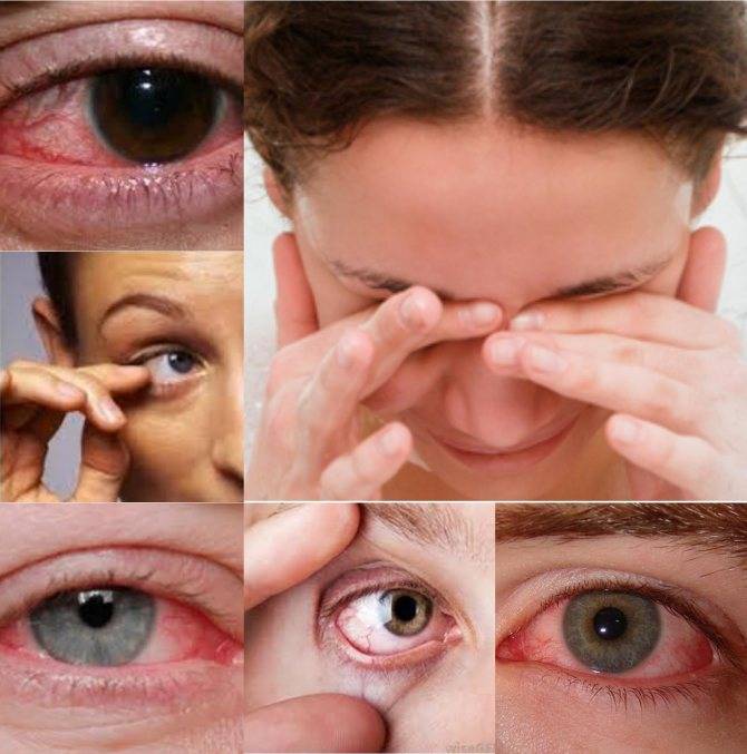 Хроническая усталость глаз: что это и как бороться - медицинский центр "терапия"