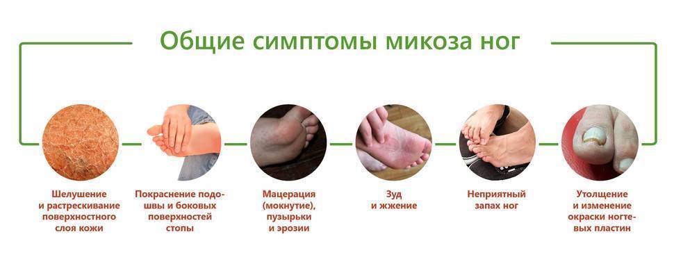 Грибковые инфекции кожи: диагностика и лечение * клиника диана в санкт-петербурге