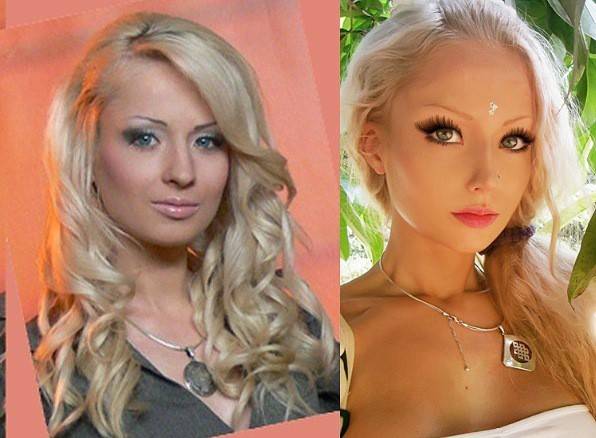 Валерия лукьянова до и после пластики: как выглядела «одесская барби» перед операциями (фото) | ddick.ru
