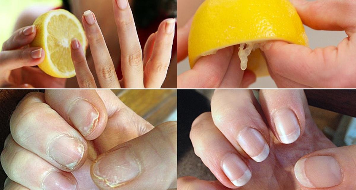 Как ускорить рост ногтей на руках