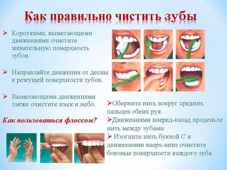 Чистка зубов от зубного камня