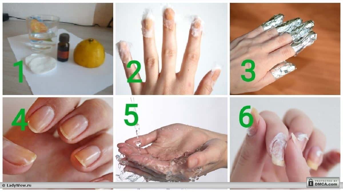 Ванночки для ногтей с йодом для роста и укрепления ногтевой пластины: рецепт, как сделать в домашних условиях, особенности применения