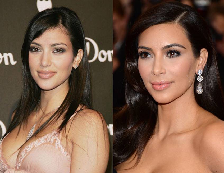 The Kardashians Without Surgery
