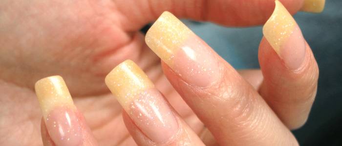 Желтые ногти на руках: причины, лечение