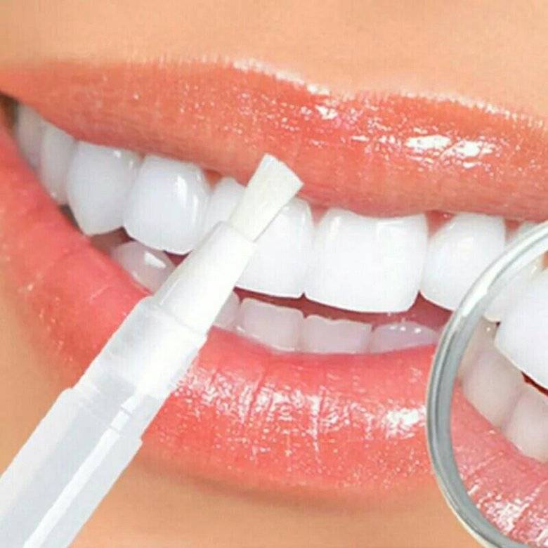 Безопасное отбеливание зубов в стоматологии и дома