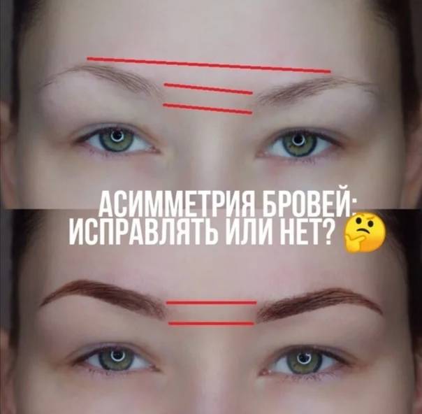 Как исправить асимметрию бровей