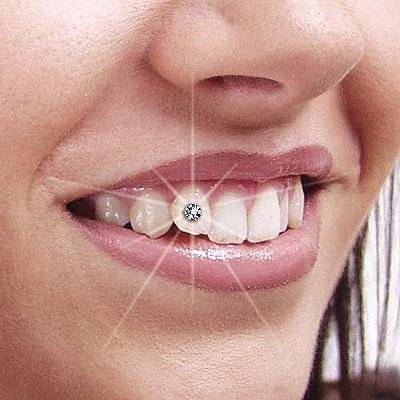 Скайс на зуб: что это и как проходит установка пирсинг в зуб