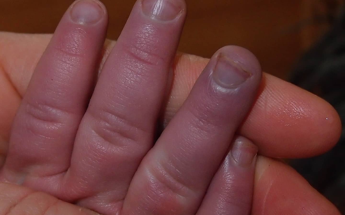 У ребенка слоятся ногти на руках и ногах: почему и что делать (причины)?