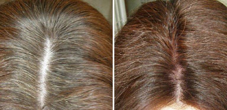 26 лучших средств против седины – как замаскировать седину с окраской волос и без