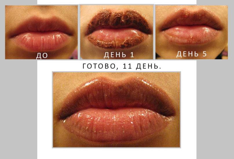 Что такое перманентный макияж губ, как его выполняют