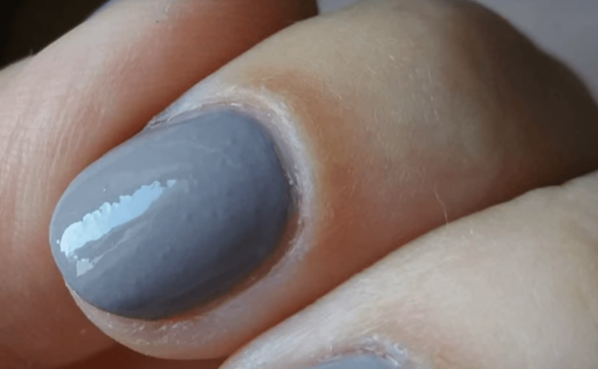 Причины пузырения лака на ногтях