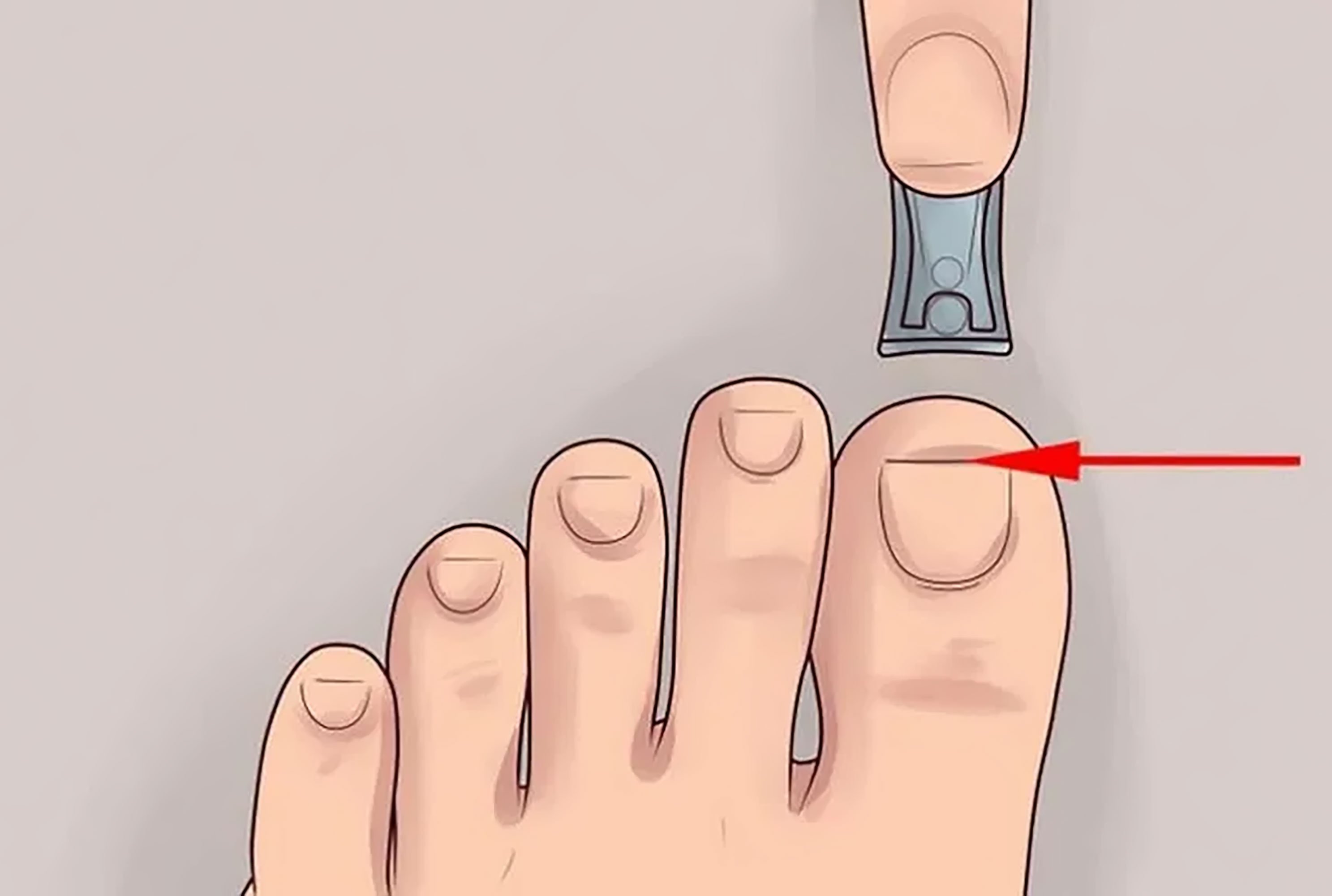 Как правильно обрезать ногти фото